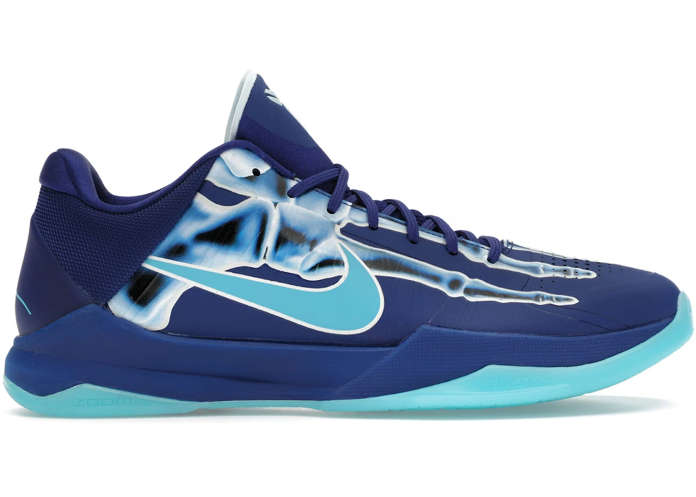 Kobe 5 X-Ray